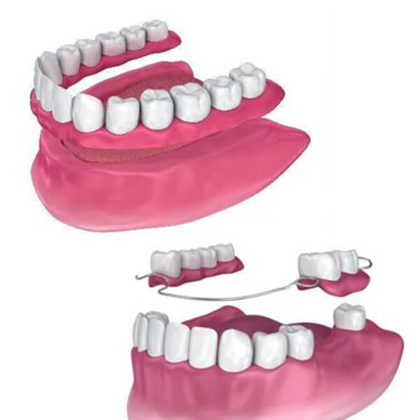 dentures